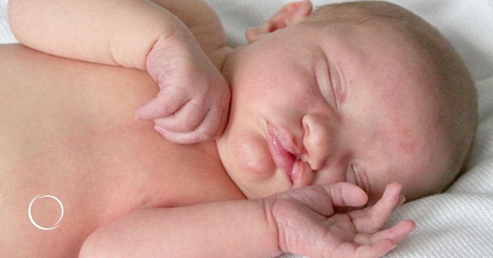 a focus on cleft lip and palate repair